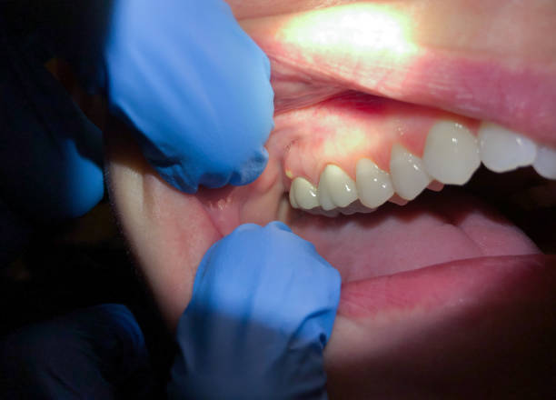 Best Urgent Tooth Repair  in Primera, TX
